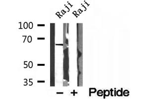 Western blot analysis of extracts of Raji cells, using MTA3 antibody. (MTA3 antibody  (Internal Region))