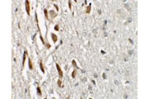 Immunohistochemistry (IHC) image for anti-Teashirt Zinc Finger Homeobox 3 (TSHZ3) (N-Term) antibody (ABIN1031649) (TSHZ3 antibody  (N-Term))