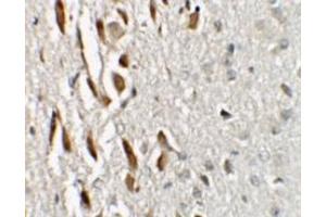Immunohistochemistry (IHC) image for anti-Zinc Finger Protein 537 (ZNF537) (N-Term) antibody (ABIN1031649)
