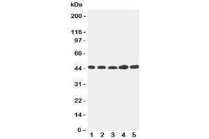 Western blot testing of Hepsin antibody and Lane 1:  293T;  2: NRK;  3: HeLa;  4: PANC;  5: MFC-7 cell lysate.