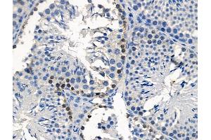 Phospho-Smad7 (Ser249) Antibody at 1/100 staining Mouse testis tissue by IHC-P.