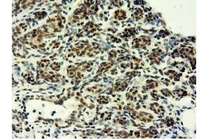 Immunohistochemical staining of paraffin-embedded Human breast tissue using anti-EPM2AIP1 mouse monoclonal antibody. (EPM2AIP1 antibody)