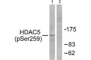 Western Blotting (WB) image for anti-Histone Deacetylase 5 (HDAC5) (pSer259) antibody (ABIN1847262) (HDAC5 antibody  (pSer259))