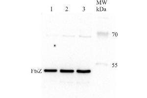 Western Blotting (WB) image for anti-Procaryotic Cell Division Gtpase (Ftsz) antibody (ABIN2749235) (Ftsz antibody)