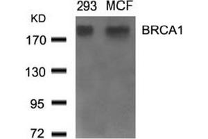 Image no. 2 for anti-Breast Cancer 1 (BRCA1) (Ser1524) antibody (ABIN401621) (BRCA1 antibody  (Ser1524))