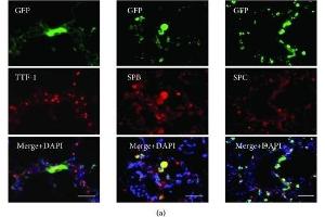 Differentiation of engrafted GFP-labeled ADSCs in the lung of the emphysematous mouse model. (Surfactant Protein C antibody  (AA 1-193))