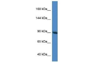 Western Blot showing Rasa1 antibody used at a concentration of 1.