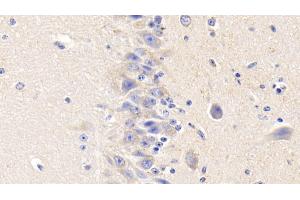 Detection of TF in Bovine Cerebellum Tissue using Polyclonal Antibody to Tissue Factor (TF) (Tissue factor antibody  (AA 36-292))