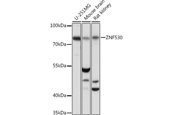 ZNF530 Antikörper  (AA 1-190)