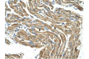HAL antibody was used for immunohistochemistry at a concentration of 4-8 ug/ml to stain Skeletal muscle cells (arrows) in Human Muscle. (HAL antibody  (C-Term))