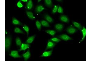 Immunofluorescence analysis of MCF7 cells using TE antibody (ABIN6129489, ABIN6148983, ABIN6148985 and ABIN6222505). (TEAD1 antibody  (AA 135-215))