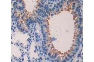 Used in DAB staining on fromalin fixed paraffin- embedded Kidney tissue (Surfactant Protein C antibody  (AA 1-193))