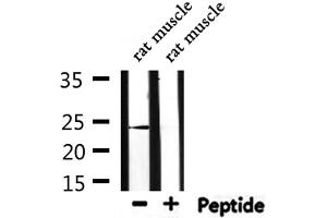 Western blot analysis of extracts from rat muscle, using PGF Antibody. (PLGF antibody  (Internal Region))