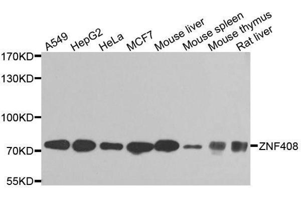 ZNF408 Antikörper  (AA 471-720)