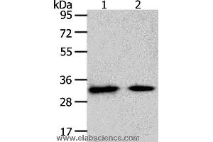 Western blot analysis of Mouse heart and muscle tissue, using SLC25A4 Polyclonal Antibody at dilution of 1:400 (SLC25A4 antibody)