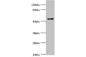 Western blot All lanes: Cytochrome P450 3A5 antibody at 9 μg/mL + Mouse liver tissue Secondary Goat polyclonal to rabbit IgG at 1/10000 dilution Predicted band size: 58, 16 kDa Observed band size: 58 kDa (CYP3A5 antibody  (AA 233-502))