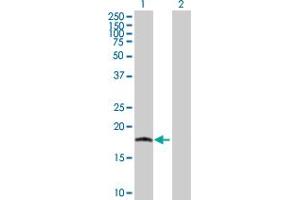 Western Blot analysis of IL17C expression in transfected 293T cell line by IL17C MaxPab polyclonal antibody.
