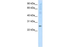 Western Blotting (WB) image for anti-Synaptosomal-Associated Protein, 25kDa (SNAP25) antibody (ABIN2463769) (SNAP25 antibody)