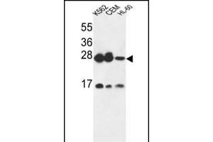 ANP32A Antibody (C-term) (ABIN6243481 and ABIN6579058) western blot analysis in K562,CEM,HL-60 cell line lysates (35 μg/lane). (PHAP1 antibody  (C-Term))