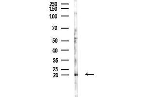 Western blot analysis of lysates from 293 cells(LPS,4h treatment), using TGF alpha Antibody at 1/1000 dilution.