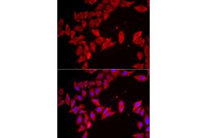 Immunofluorescence analysis of HeLa cells using SLC35 antibody (ABIN6133144, ABIN6147991, ABIN6147992 and ABIN6223068). (SLC35A2 antibody  (AA 1-242))