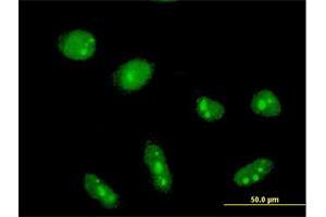 Immunofluorescence of monoclonal antibody to CYLD on HeLa cell.