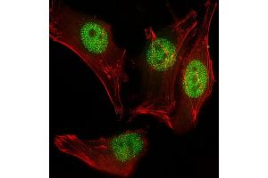Immunofluorescent analysis of 4 % paraformaldehyde-fixed, 0. (MYOD1 antibody  (AA 211-240))