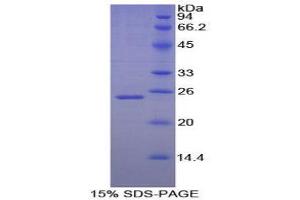 SDS-PAGE (SDS) image for Noggin (NOG) (AA 28-240) protein (His tag) (ABIN1171050) (NOG Protein (AA 28-240) (His tag))