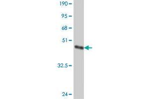 Western Blot detection against Immunogen (37. (SMARCC1 antibody  (AA 338-437))