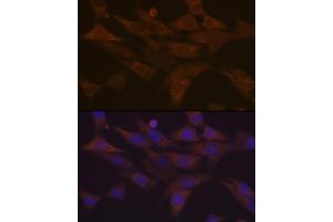Immunofluorescence analysis of NIH-3T3 cells using PKC delta Rabbit mAb  at dilution of 1:100 (40x lens). (PKC delta antibody)
