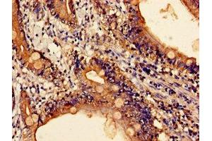 Immunohistochemistry of paraffin-embedded human small intestine tissue using ABIN7147027 at dilution of 1:100 (Cathepsin Z antibody  (AA 127-287))