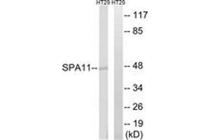 Western blot analysis of extracts from HT-29 cells, using SERPINA11 Antibody. (SERPINA11 antibody  (AA 191-240))