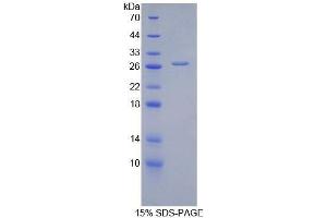 SDS-PAGE (SDS) image for Alanine Aminotransferase (ALT) (AA 255-492) protein (His tag) (ABIN2120489) (ALT Protein (AA 255-492) (His tag))
