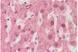 Immunohistochemistry (IHC) image for anti-Cytochrome P450, Family 3, Subfamily A, Polypeptide 4 (CYP3A4) (AA 398-447) antibody (ABIN6754944)