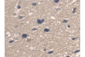 Detection of PNPO in Mouse Cerebrum Tissue using Polyclonal Antibody to Pyridoxamine-5'-Phosphate Oxidase (PNPO) (PNPO antibody  (AA 1-261))