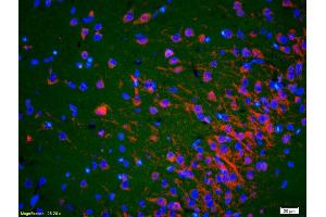 Formalin-fixed and paraffin-embedded rat brain labeled with Anti-ACTH (18-39) Polyclonal Antibody, Unconjugated (ABIN668661) 1:200, overnight at 4°C, The secondary antibody was Goat Anti-Rabbit IgG, Cy3 conjugated used at 1:200 dilution for 40 minutes at 37°C. (ACTH antibody  (AA 18-39))