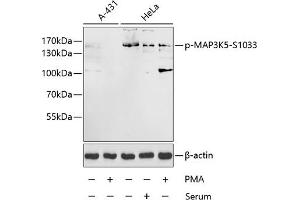 Western blot analysis of extracts of A-431 and HeLa cells, using Phospho-MK5-S1033 antibody (ABIN3019484, ABIN3019485, ABIN3019486 and ABIN6225423) at 1:1000 dilution. (ASK1 antibody  (pSer1033))