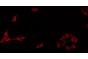 ABIN6272249 staining Hela by IF/ICC. (ARRDC1 antibody  (C-Term))