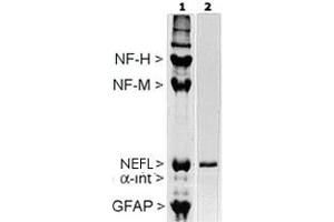 Rat spinal cord homogenate showing the major intermediate filament proteins of the nervous system (lane 1). (NEFL antibody)