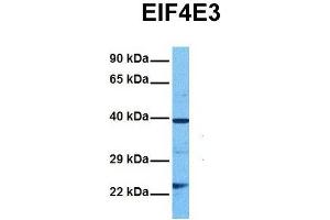 Host:  Rabbit  Target Name:  EIF4E3  Sample Tissue:  Human DLD1  Antibody Dilution:  1. (EIF4E3 antibody  (Middle Region))