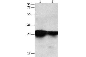 Western Blot analysis of Human brain malignant glioma and laryngocarcinoma tissue using 14-3-3 epsilon Polyclonal Antibody at dilution of 1:2200 (YWHAE antibody)
