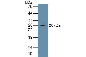 Detection of Recombinant PDGFB, Porcine using Polyclonal Antibody to Platelet Derived Growth Factor Subunit B (PDGFB) (PDGFB antibody  (AA 84-199))