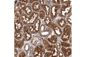 Immunohistochemical staining of human kidney with TRMT61B polyclonal antibody  shows strong cytoplasmic positivity in tubular cells. (TRMT61B antibody)