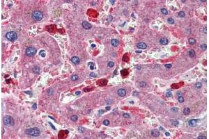 Human Liver: Formalin-Fixed, Paraffin-Embedded (FFPE) (CBS antibody  (AA 1-101))