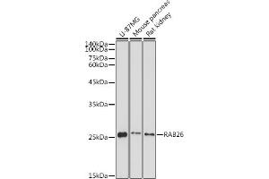 Western blot analysis of extracts of various cell lines, using R antibody (ABIN7269802) at 1:1000 dilution. (RAB26 antibody  (AA 1-60))