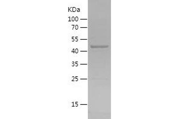 AIFM2 Protein (AA 161-373) (His-IF2DI Tag)