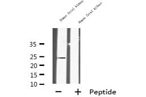 Western blot analysis of INSL6 expression in Human fetal kidney lysate,The lane on the left is treated with the antigen-specific peptide. (INSL6 antibody  (Internal Region))