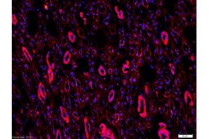 Formalin-fixed and paraffin-embedded human kidney labeled with Anti-CD54/ICAM-1 Polyclonal Antibody, Unconjugated (ABIN707651) 1:200, overnight at 4°C, The secondary antibody was Goat Anti-Rabbit IgG, Cy3 conjugated used at 1:200 dilution for 40 minutes at 37°C. (ICAM1 antibody  (AA 51-100))
