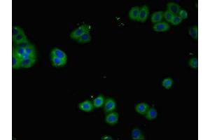 Immunofluorescent analysis of HepG2 cells using ABIN7156842 at dilution of 1:100 and Alexa Fluor 488-congugated AffiniPure Goat Anti-Rabbit IgG(H+L) (CD25 antibody  (AA 22-185))