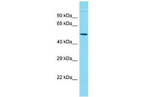 Host: Rabbit Target Name: KRT38 Sample Type: Jurkat Whole Cell lysates Antibody Dilution: 1.